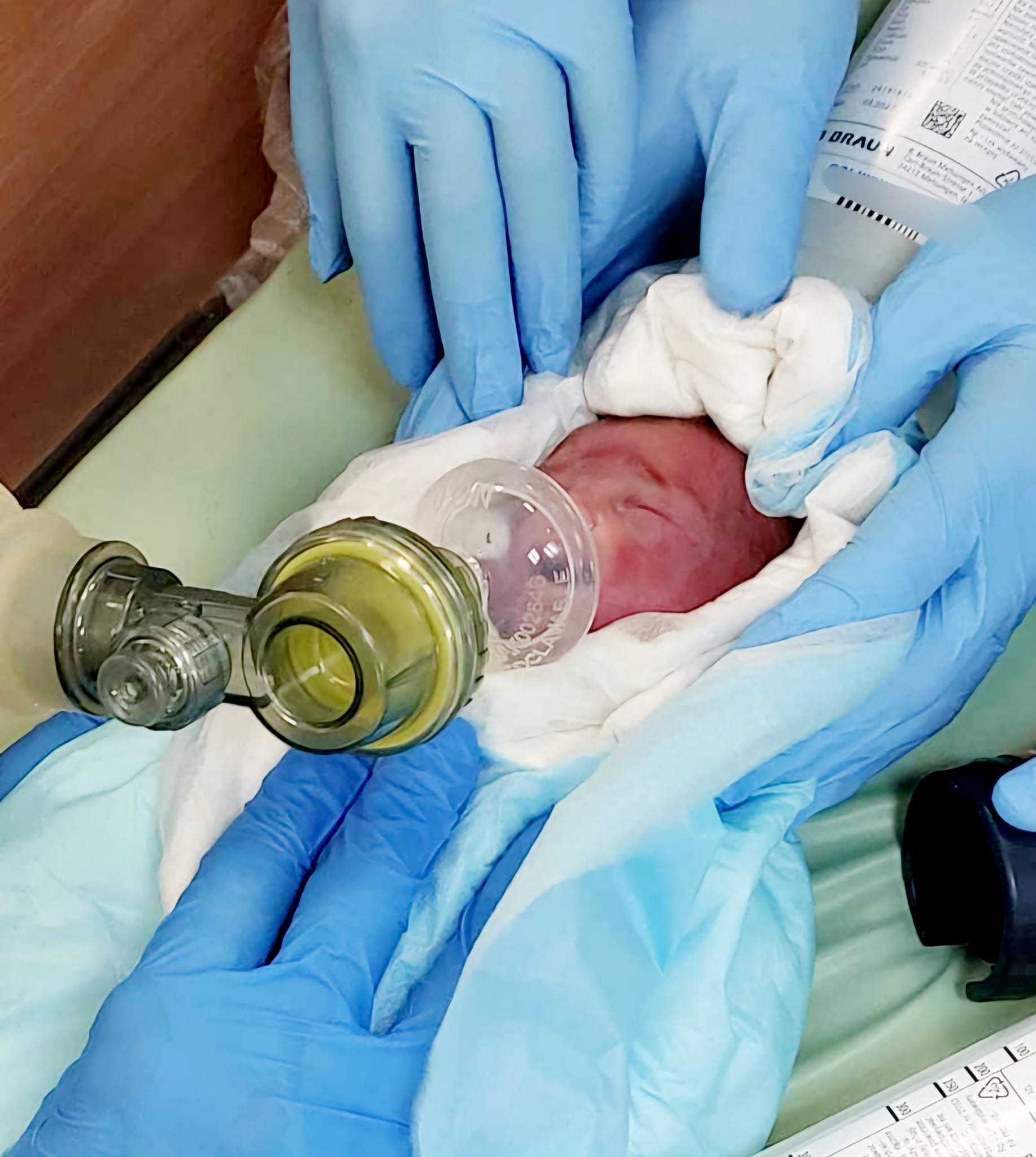 Cud w poznańskim szpitalu. Urodziła syna w 29. tygodniu ciąży